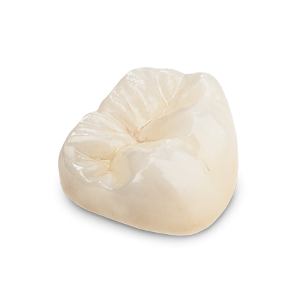 Full-Contour Zirconia